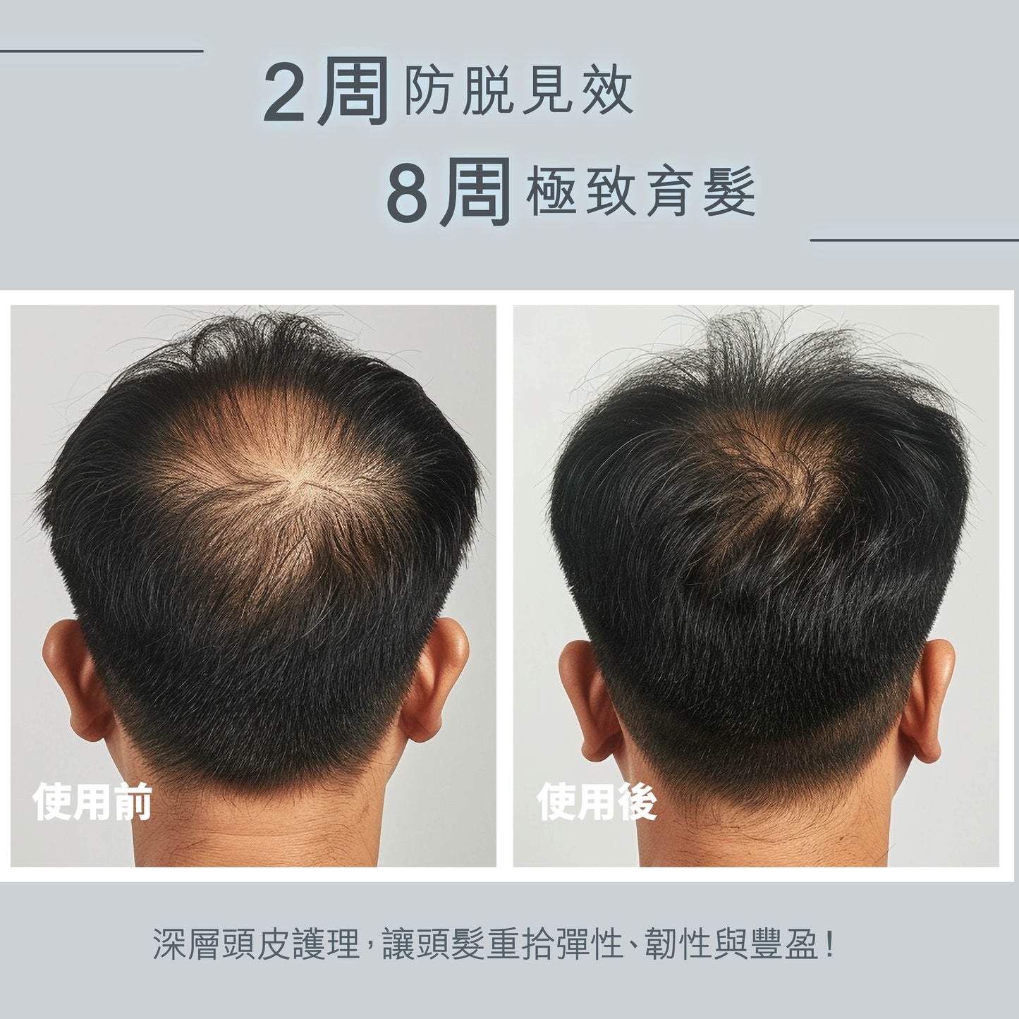 DR ZERO 根源賦能EX男士護髮素