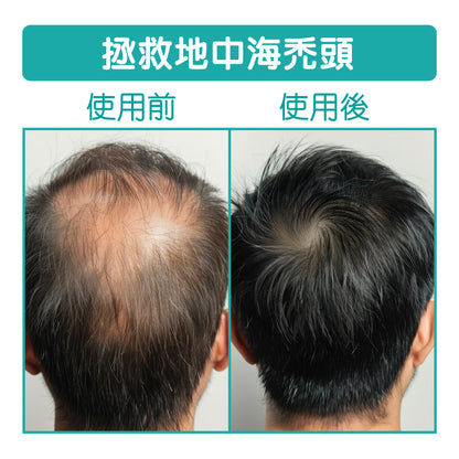 DR ZERO 逆齡生髮男士專用配方